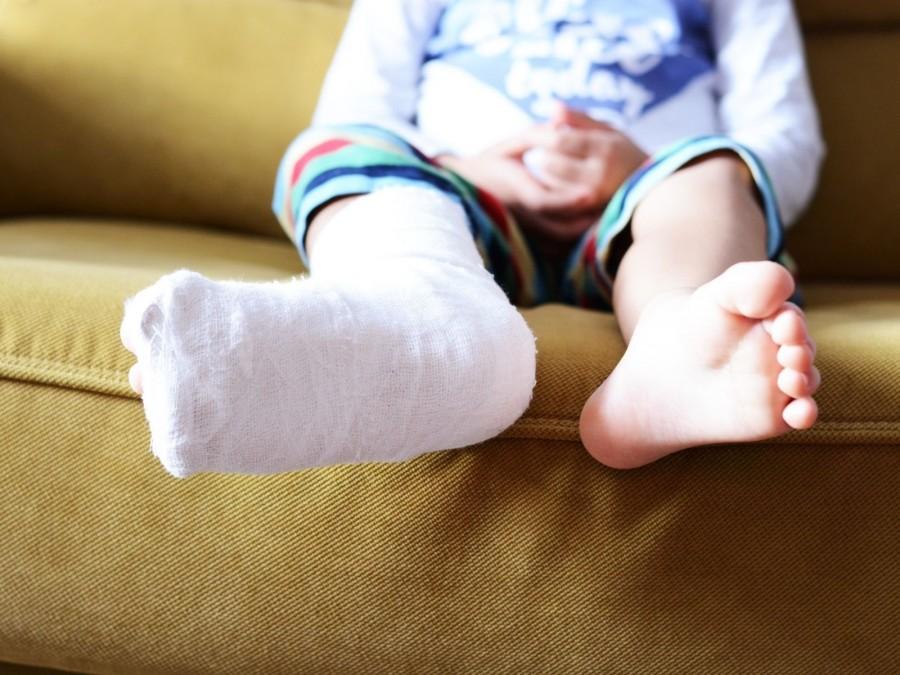 Kleines Kind mit Gipsbein sitzt auf einem grünen Sofa. Tagespflegenest, Kita, Kindergarten, Kinderbetreuung, Pflegevater, Pflegemutter, Kindertagespflege, Unfallversicherung.