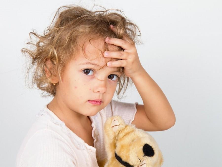Kleinkind mit Teddy hält sich die Hand an die Stirn. Im Gesicht sind Masern zu sehen. Virus, Infektionskrankheit, Tagespflegedienst, Kita, Kindergarten, Kinderbetreuung, Pflegevater, Pflegemutter, Kinderkrankheit, Schutzimpfung.